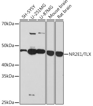 NR2E1/TLX Rabbit Monoclonal Antibody