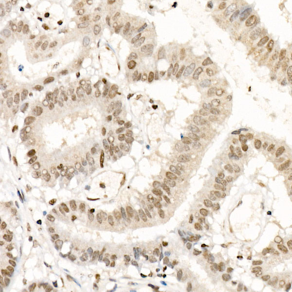 NR2F1 Rabbit Polyclonal Antibody
