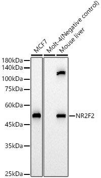 NR2F2 Rabbit Polyclonal Antibody