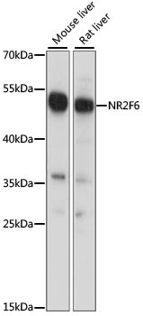 NR2F6 Rabbit Polyclonal Antibody