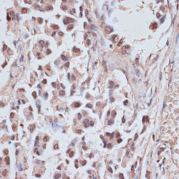 NR5A2 Rabbit Polyclonal Antibody