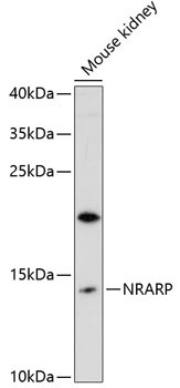 NRARP Rabbit Polyclonal Antibody
