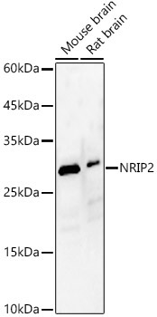 NRIP2 Rabbit Polyclonal Antibody