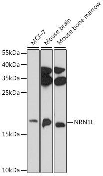 NRN1L Rabbit Polyclonal Antibody