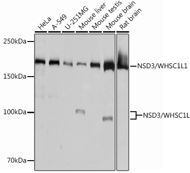 NSD3/WHSC1L1 Rabbit Monoclonal Antibody