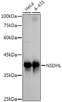 NSDHL Rabbit Monoclonal Antibody
