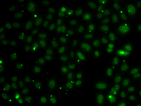 NSL1 Rabbit Polyclonal Antibody