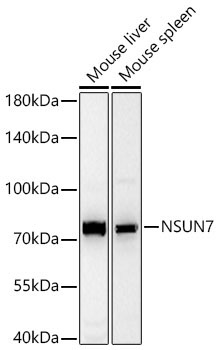 NSUN7 Rabbit Polyclonal Antibody