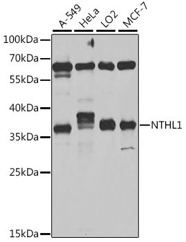 NTHL1 Rabbit Polyclonal Antibody