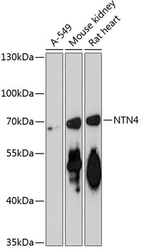 NTN4 Rabbit Polyclonal Antibody