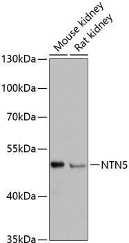 NTN5 Rabbit Polyclonal Antibody
