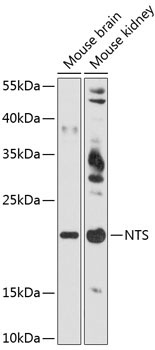 NTS Rabbit Polyclonal Antibody