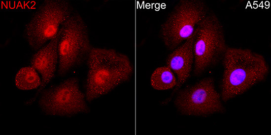 NUAK2 Rabbit Polyclonal Antibody