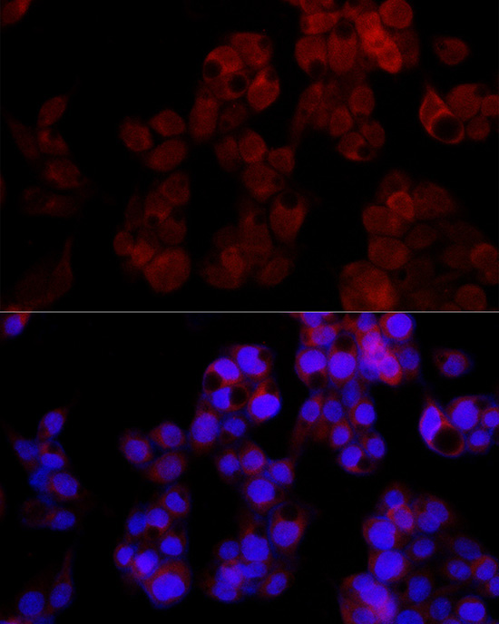 NUDT5 Rabbit Monoclonal Antibody - Image 2