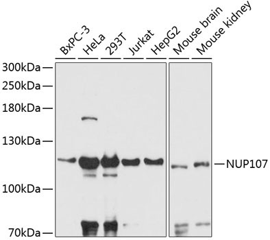 NUP107 Rabbit Polyclonal Antibody