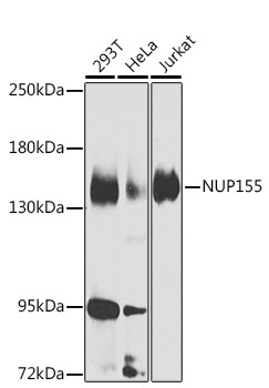 NUP155 Rabbit Polyclonal Antibody