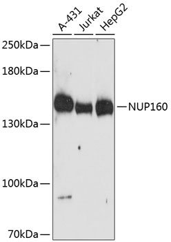 NUP160 Rabbit Polyclonal Antibody