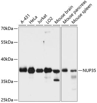 NUP35 Rabbit Polyclonal Antibody