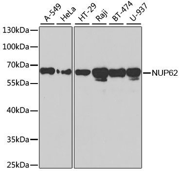 NUP62 Rabbit Polyclonal Antibody
