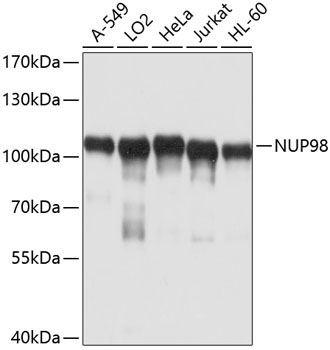 NUP98 Rabbit Polyclonal Antibody
