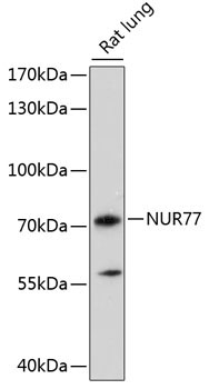 NUR77 Rabbit Polyclonal Antibody