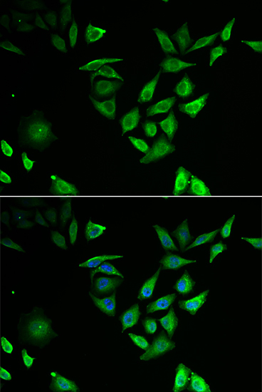 NUTF2 Rabbit Polyclonal Antibody
