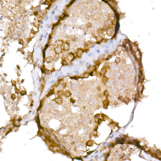 NY-ESO-1 Rabbit Polyclonal Antibody - Image 2