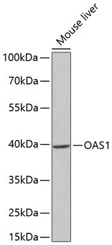 OAS1 Rabbit Polyclonal Antibody