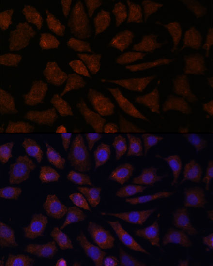 OAS3 Rabbit Polyclonal Antibody - Image 2