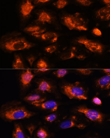 OAS3 Rabbit Polyclonal Antibody - Image 3