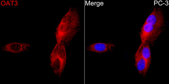OAT3 Rabbit Polyclonal Antibody