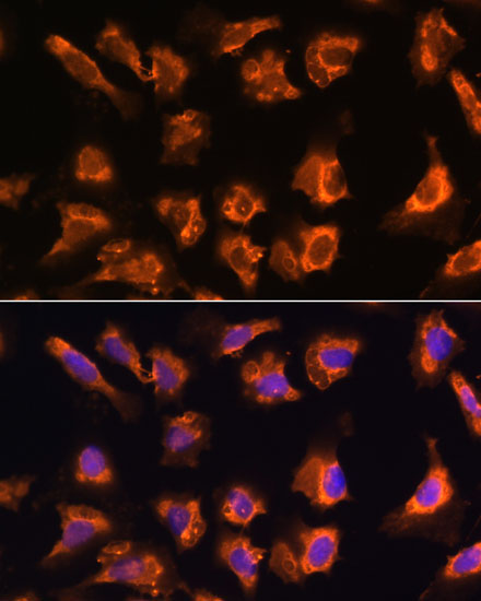 OBSCN Rabbit Polyclonal Antibody
