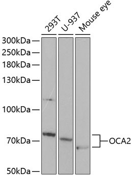 OCA2 Rabbit Polyclonal Antibody