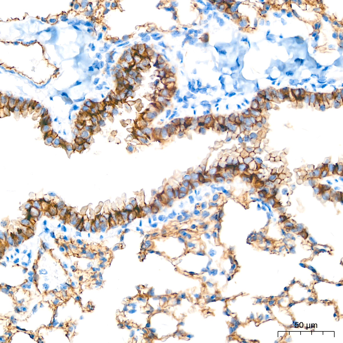 Occludin Rabbit Polyclonal Antibody - Image 2