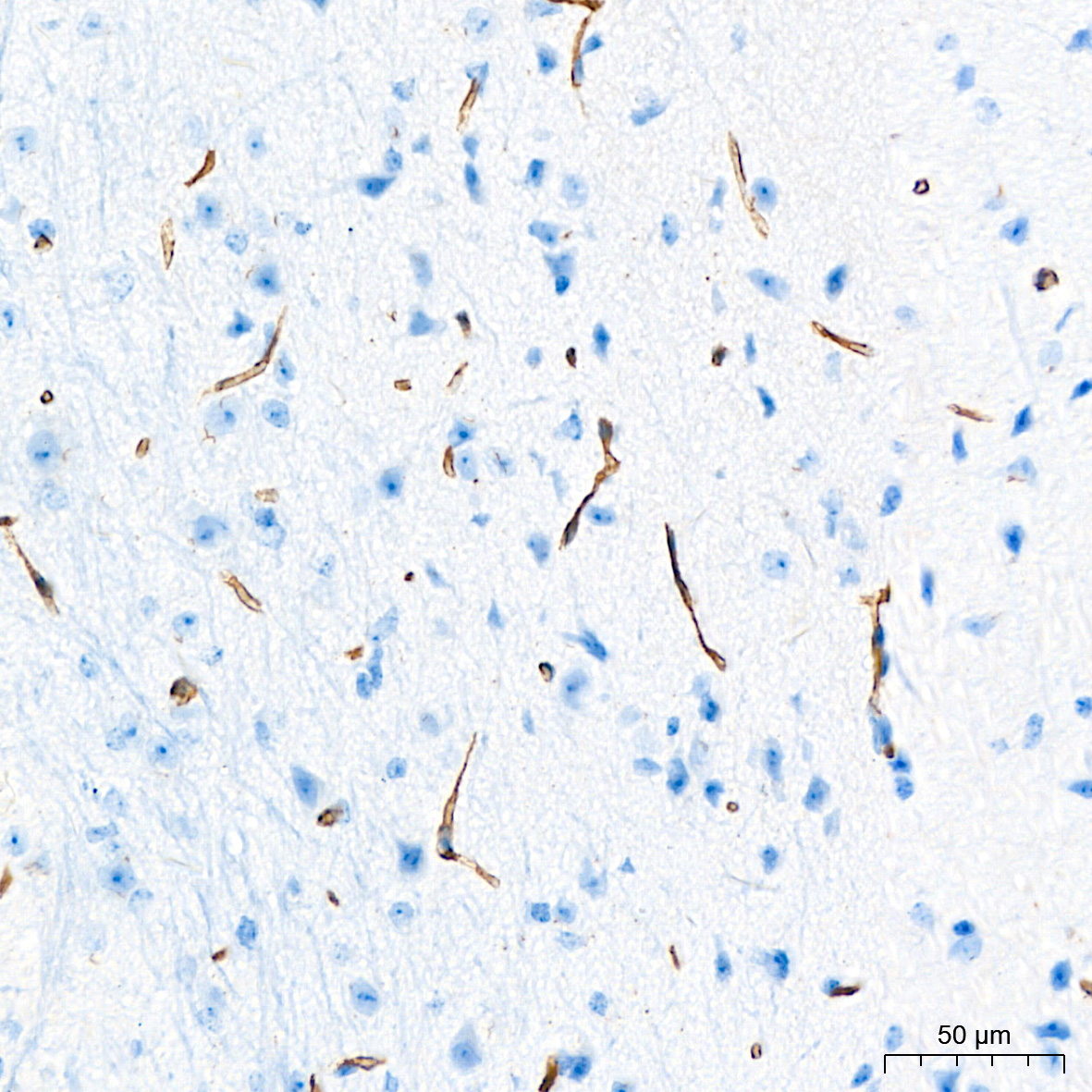 Occludin Rabbit Polyclonal Antibody - Image 5