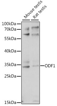 ODF1 Rabbit Polyclonal Antibody