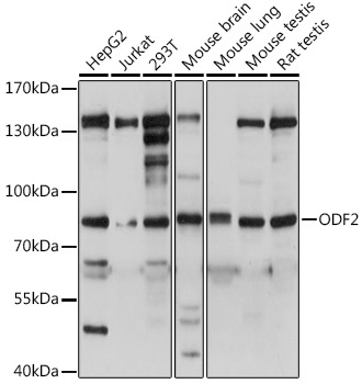 ODF2 Rabbit Polyclonal Antibody