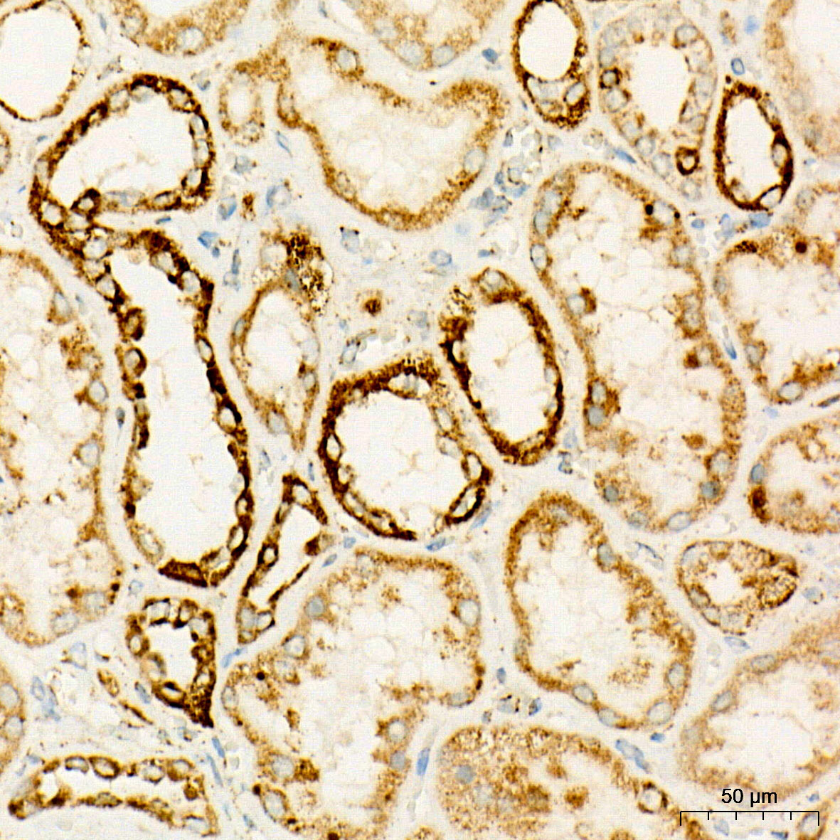 OGDH Rabbit Monoclonal Antibody - Image 4