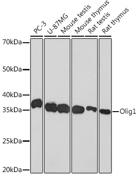 Olig1 Rabbit Monoclonal Antibody