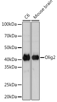Olig2 Rabbit Monoclonal Antibody