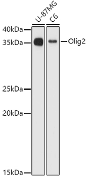 Olig2 Rabbit Polyclonal Antibody