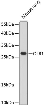 OLR1 Rabbit Polyclonal Antibody