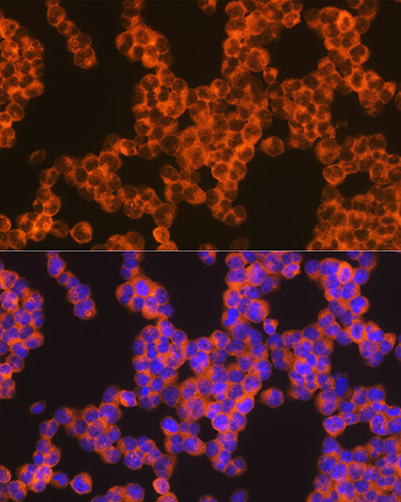 Oncostatin M Rabbit Monoclonal Antibody - Image 2