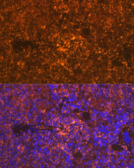 Oncostatin M Rabbit Monoclonal Antibody - Image 3