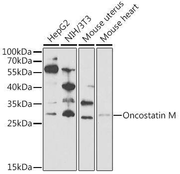 Oncostatin M Rabbit Polyclonal Antibody