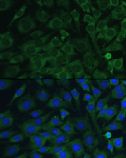 Oncostatin M Rabbit Polyclonal Antibody - Image 2