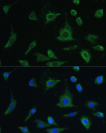 Oncostatin M Rabbit Polyclonal Antibody - Image 3