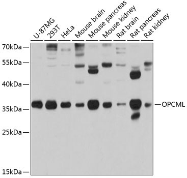 OPCML Rabbit Polyclonal Antibody