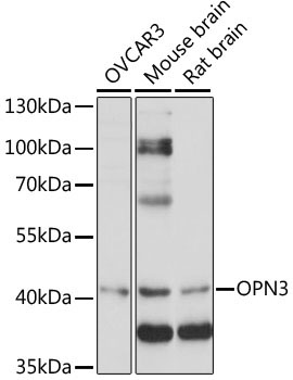 OPN3 Rabbit Polyclonal Antibody