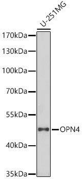 OPN4 Rabbit Polyclonal Antibody